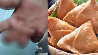 मुंबई : समोशाच्या पैशांवरुन वाद, ग्राहकाने दातांनी तोडले दुकानदाराचे बोट; धक्कादायक प्रकरण Mumbai Tak