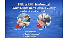 Ïmpact feature: मुंबईत FUE की DHI: क्लिनिक स्पष्टपणे न सांगणाऱ्या गोष्टी आणि कन्सल्टमध्ये काय विचारावं fue vs dhi in mumbai what clinics dont clearly tell you and what to ask during the consultation