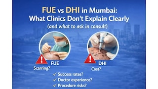 Ïmpact feature: मुंबईत FUE की DHI: क्लिनिक स्पष्टपणे न सांगणाऱ्या गोष्टी आणि कन्सल्टमध्ये काय विचारावं Mumbai Tak
