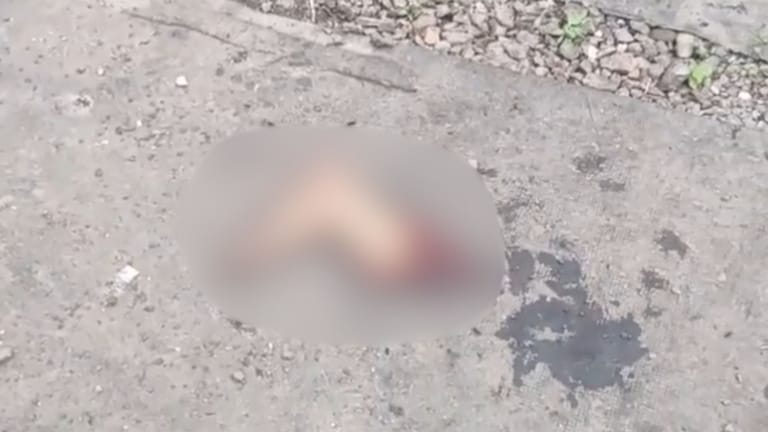 बीड : परळीत आढळला माणसाचा तुटलेला पाय, नेमका प्रकार काय? Beed News