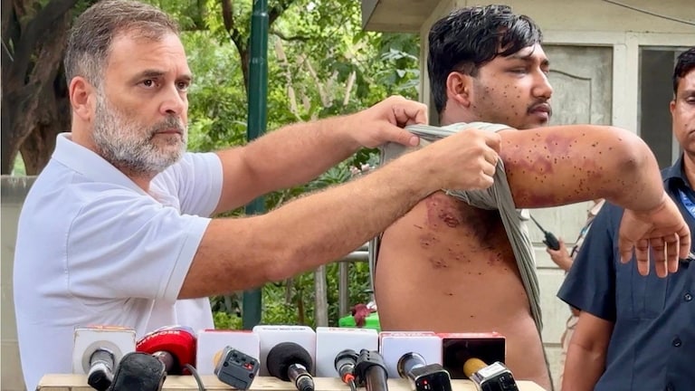 'डोळा वाचेल की नाही... शरीरावर भयंकर वळ अन् पॅलेट गनचा मारा...', 'त्या' पोराला राहुल गांधींनी आणलं समोर! Rahul Gandhi Press Conference use of pellet gun against student