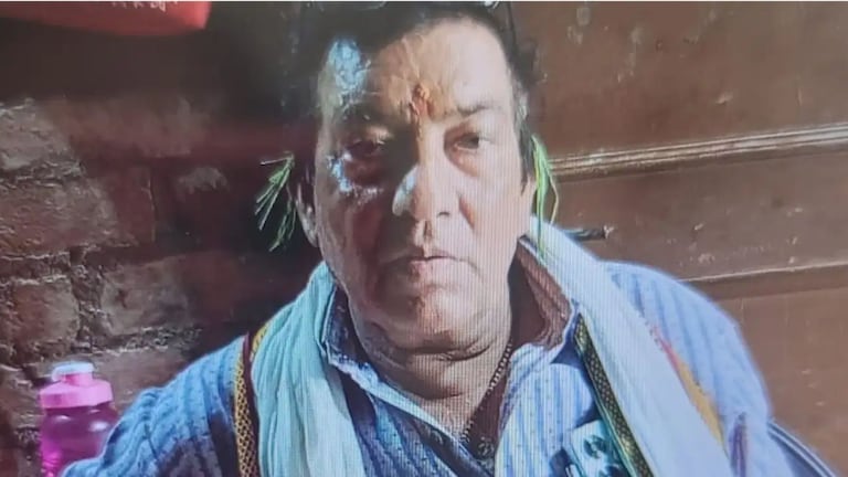 महिलेने क्रूरतेची सीमा गाठली, तिसऱ्या पतीला जिवंत जाळलं, असं काय घडलं? Crime News