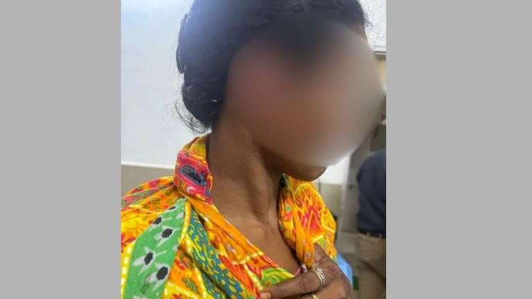 धाकटी जाऊ संतापली, थोरल्या जावेचे दाताने थेट कानच तोडले, नेमकं कारण काय? Crime News