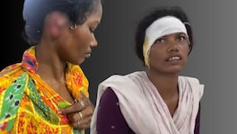 जमिनीचा वाद विकोपाला, लहान जावेनं मोठ्या जावेचा चावला कान crime news