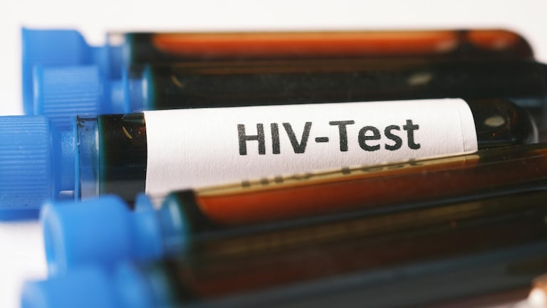 'कॉलेजचे 7 हजार विद्यार्थी HIV पॉझिटिव्ह', हा दावा अन् सगळेच हादरले.. सरकारकडून स्पष्टीकरण जारी claim of 7000 college students hiv positive is fake karnataka government clarifies and warns of action against those spreading rumors