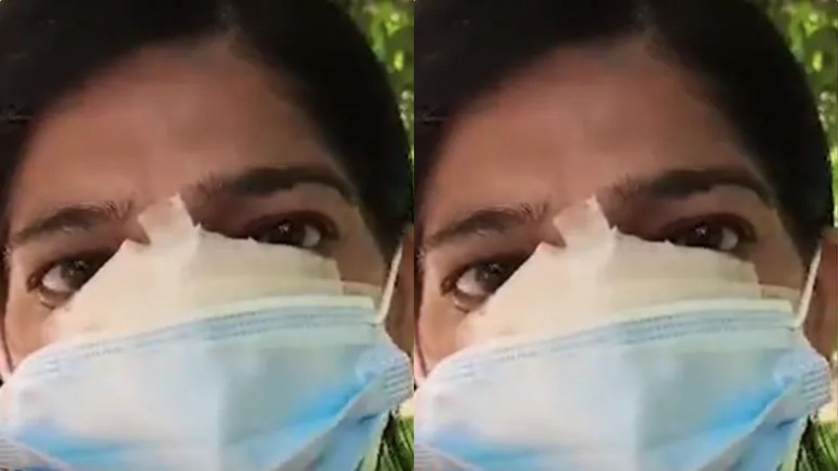 भिक्षा देण्यास महिलेचा नकार, भिकाऱ्याने पीडितेचं नाक चावून केली इजा 