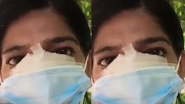 भिक्षा देण्यास महिलेचा नकार, भिकाऱ्याने पीडितेचं नाक चावून केली इजा Crime News