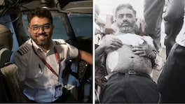 'त्याने माझ्यावर अनेक वार केले...', भारताचा ढाण्या वाघ... कॅप्टन स्मितचा हल्ल्यानंतरचा पहिला VIDEO he struck me several times but says blood soaked pilot smit machchhar video from after mid flight attack