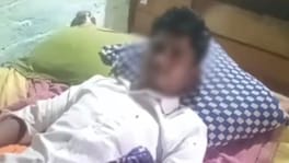 मुलांच्या भांडणातून वाद; महिलेने दीराच्या गुप्तांगाला घेतला चावा, 55 टाके Kanpur Crime News