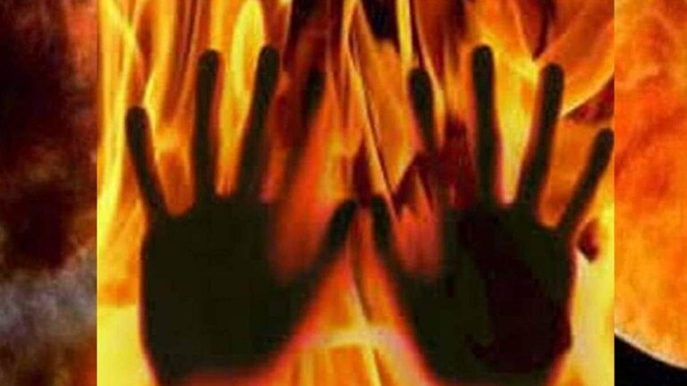 प्रेयसीला पेटवणाऱ्या प्रियकराचाच मृत्यू, मुंबईतील खळबळजनक घटना Mumbai Tak