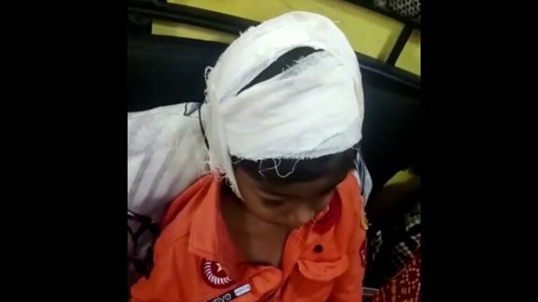 कल्याण: 4 वर्षाच्या मुलावर तीन भटक्या कुत्र्यांचा हल्ला, तब्बल 18 ठिकाणी चावा Mumbai Tak