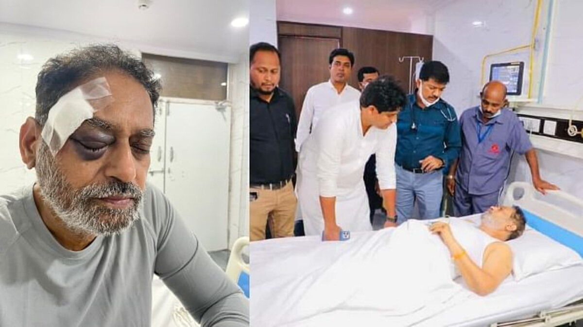 नितीन राऊतांच्या डोक्याला मार, भारत जोडो यात्रेदरम्यान कसे झाले जखमी? Mumbai Tak