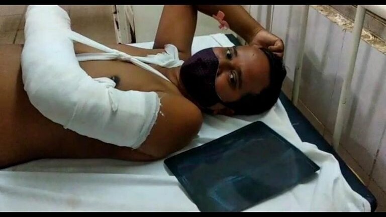 केंद्रीय मंत्र्याने खोली बंद करून अधिकाऱ्यांना केली बेदम मारहाण; एकाचा हातच मोडला Mumbai Tak