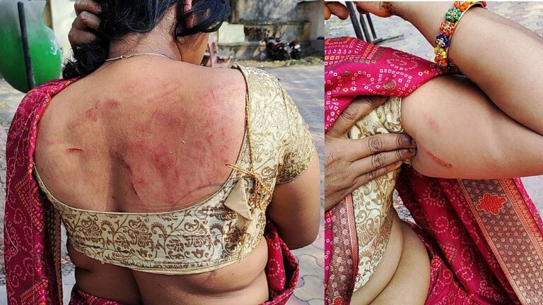 संतापजनक! शिवसेना आमदाराकडून महिलेला रस्त्यावरच लाथाबुक्क्यांनी बेदम मारहाण Mumbai Tak