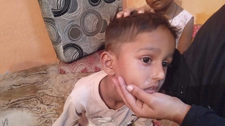 यवतमाळ : एकाच कुटुंबातील तीन चिमुरड्यांवर ज्वलनशील द्रव्याने हल्ला Mumbai Tak