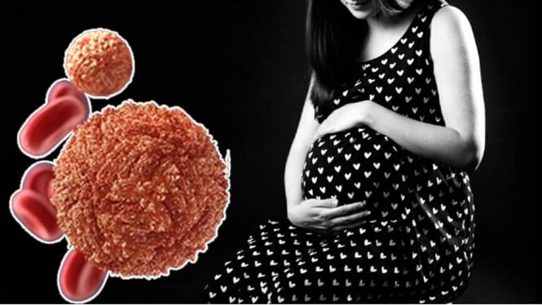 पुण्यात आढळला झिका व्हायरसचा रुग्ण! गर्भवती महिलांना जास्त धोका… काय आहेत लक्षणे? Mumbai Tak