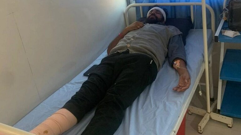 बच्चू कडू यांचा अपघात, पायाला आणि डोक्याला जबर मार, नक्की काय घडलं? Mumbai Tak