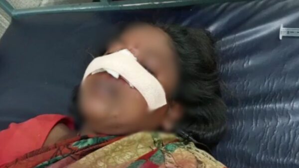 Crime news : A young man attacked a woman with a sharp sickle and cut off her nose