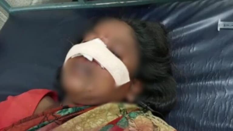 Crime : 3 वर्षांपासून देत होता धमकी… अखेर विळा घेऊन आला अन् भर रस्त्यात कापलं महिलेचं नाक Crime news : A young man attacked a woman with a sharp sickle and cut off her nose