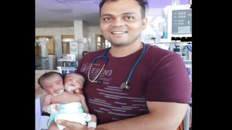अजबच… एक हृदय, एक शरीर पण डोकी दोन, महिलेने दिला तिळ्यांना जन्म women gave birth three children two babies are conjoined twins while third was born normally jalgaun story