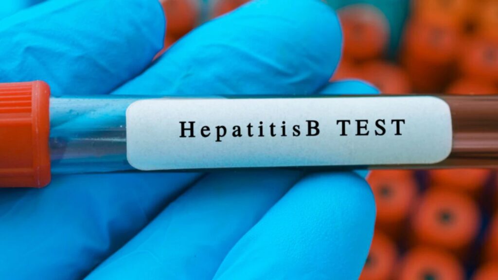 Hepatitis B Death of 14-year-old boy nair hospital