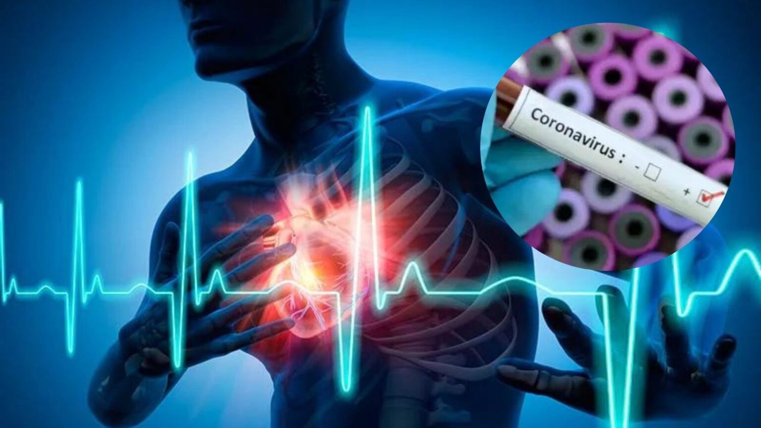 Is there really Corona connection of Heart Attack Increasing incidence of heart disease at a young age What is viral Tweet