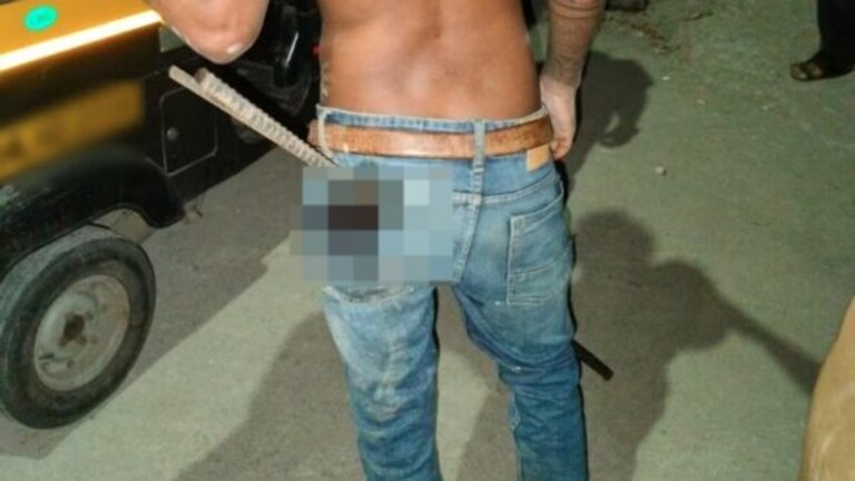 Thane: बाप रे! कंबरेत घुसलेली सळई तरूणाच्या थेट जांघेतून आरपार Thane News 19 years Boy Fall On Iron Rod it penetrated the waist directly through the thigh