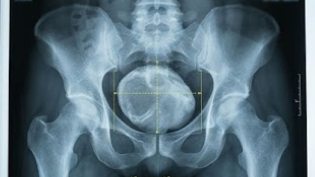 Medical Miracle