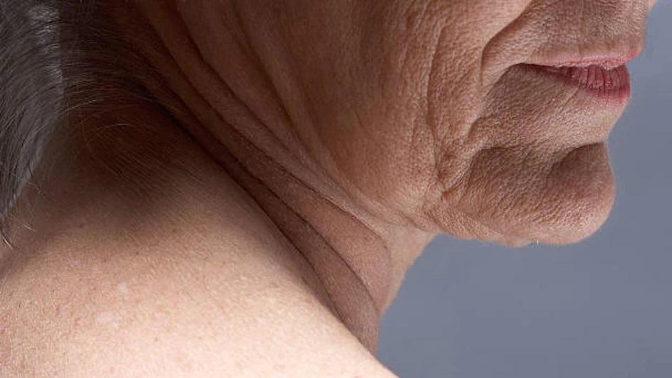 skincare tips in bengali for wrinkles and fine lines 