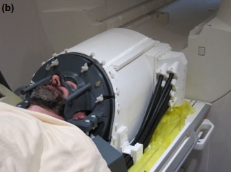 Ultrasound Helmet