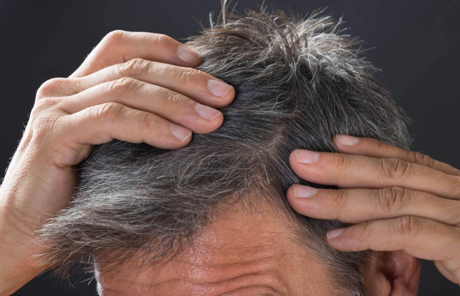 grey hair