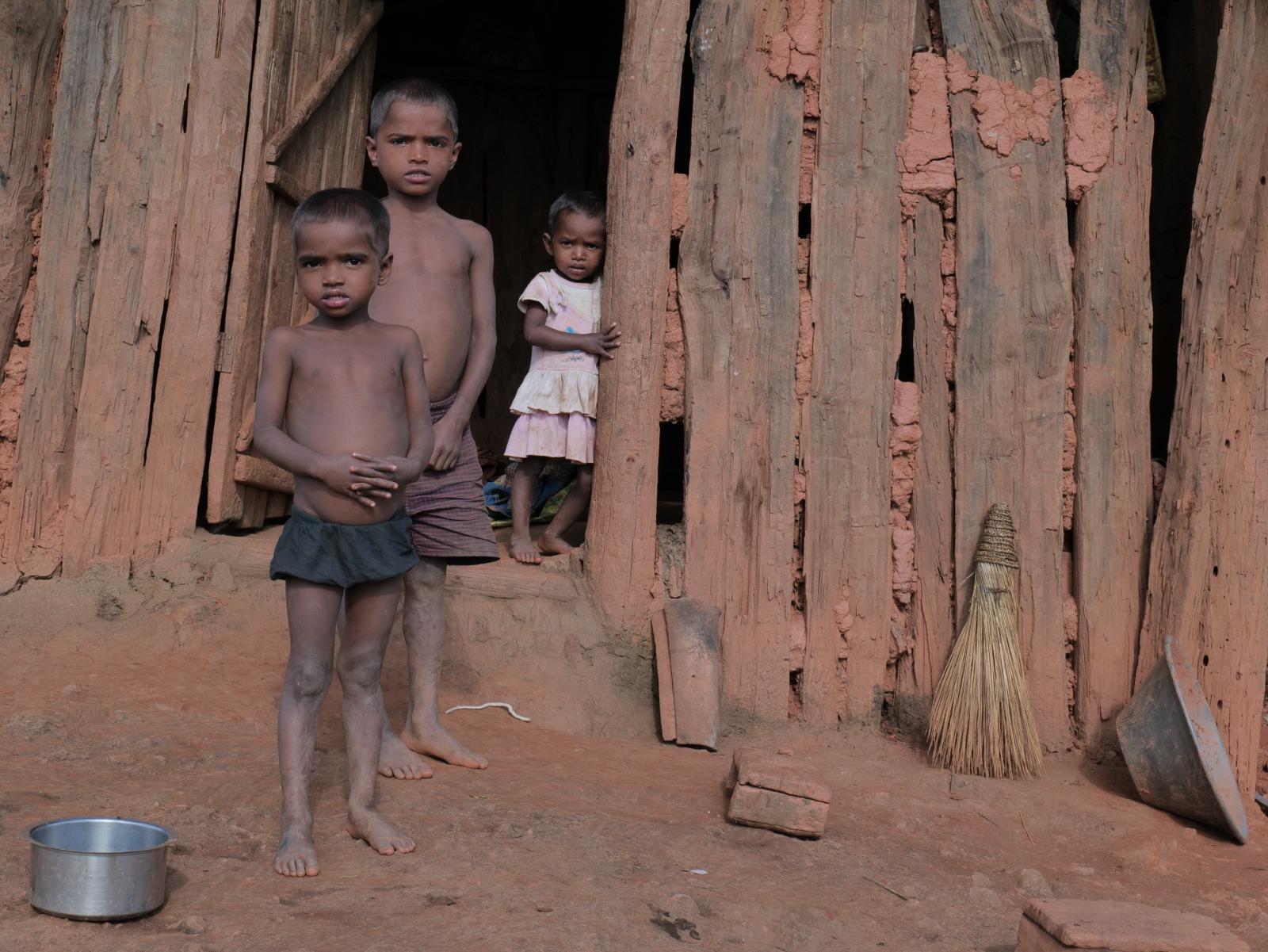 झारखंड के पांच साल से कम उम्र के 67 फीसदी बच्चे एनीमिया के शिकार हैं