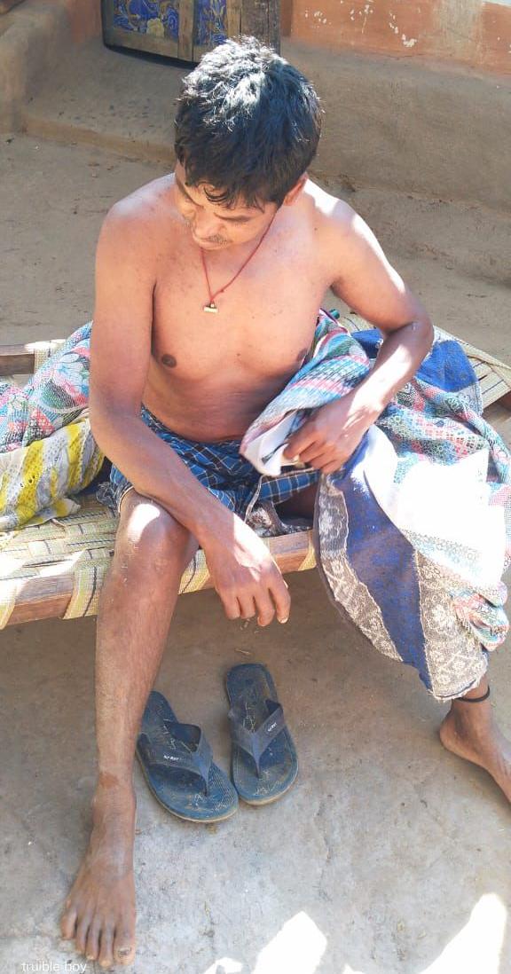 दसरू का आरोप है कि DRG के जवानों ने उनके साथ मारपीट की है