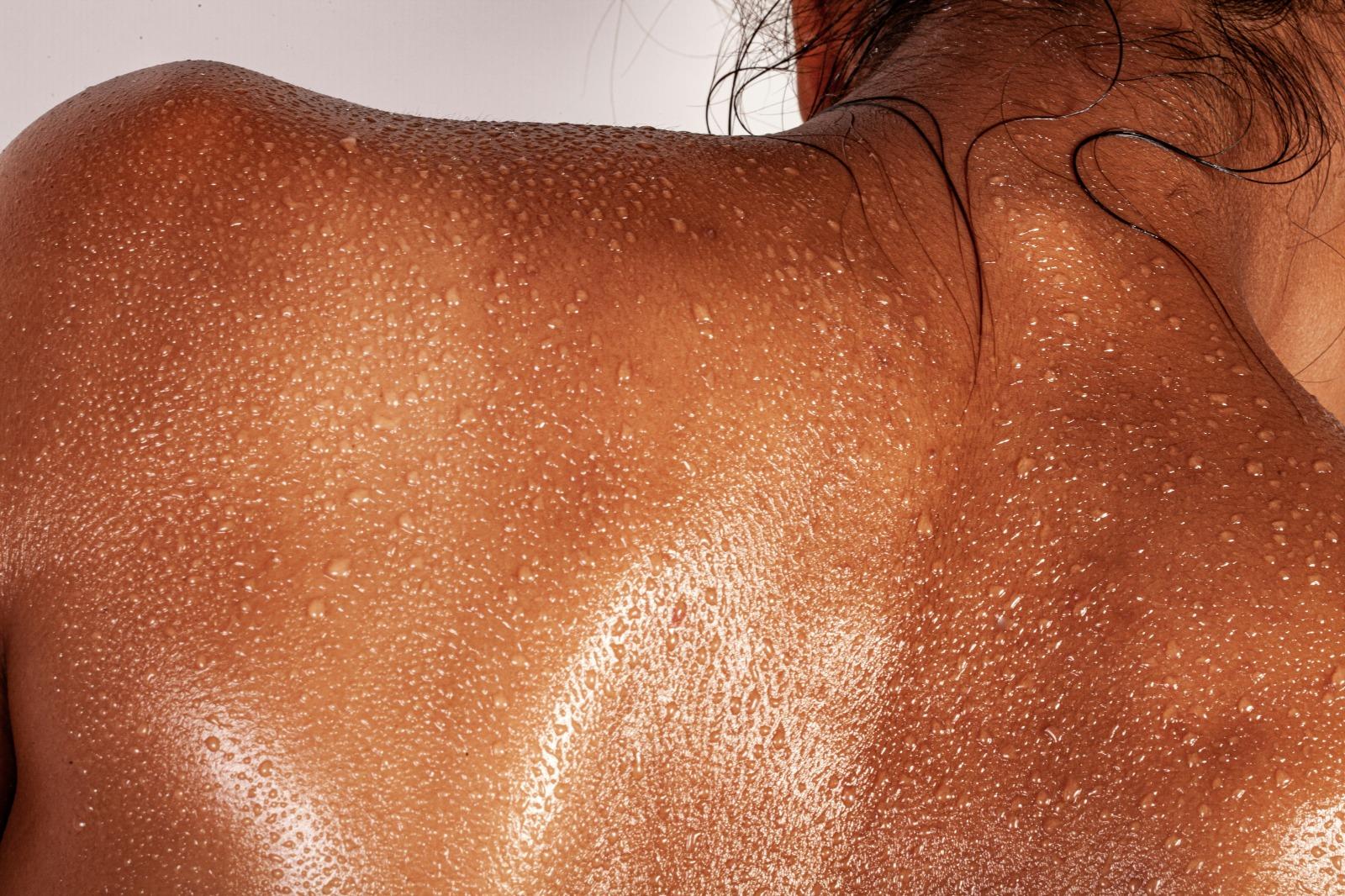 UV radiation