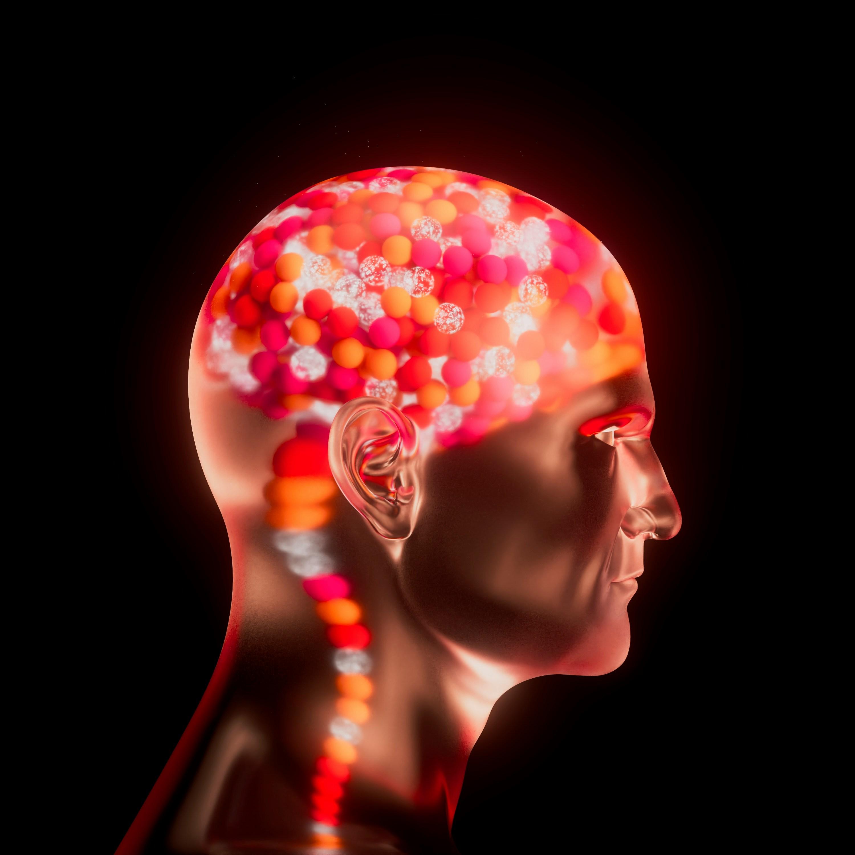 Alzheimer