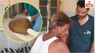 डेढ़ किलो का पत्थर अंदर कैसे घुस गया? बवासीर के इलाज के लिए नीम हकीम ने दी थी अजीबोगरीब सलाह Kanpur News