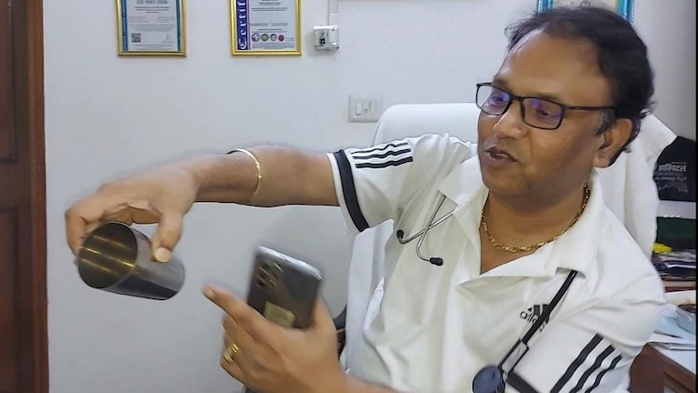 जौनपुर: आंत में फंसा ग्लास बना रहस्य! ऑपरेशन कर निकाला गया, जानें हैरान कर देनी वाली कहानी UP Tak