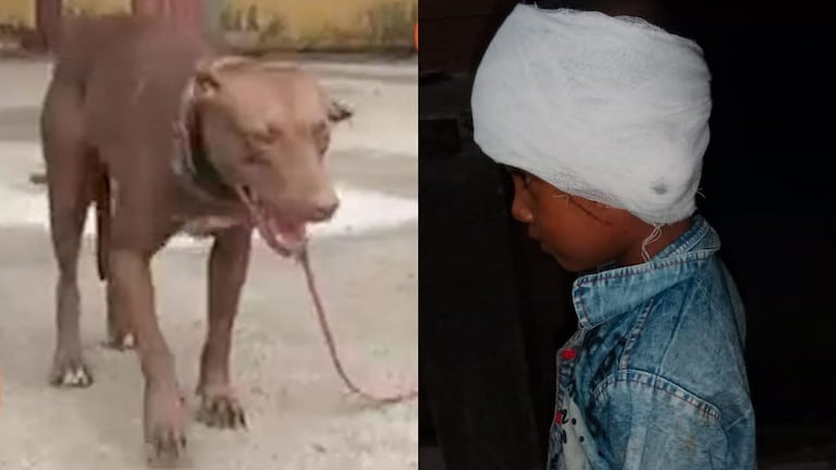 लखनऊ-मेरठ के बाद अब गाजियाबाद में Pitbull का आतंक! पिटबुल कुत्ते ने बच्ची का काट खाया  कान UP Tak