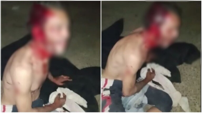 आगरा: पालतू जर्मन शेफर्ड डॉग ने किया बुजुर्ग के सिर और गर्दन पर हमला, हालत गंभीर UP Tak