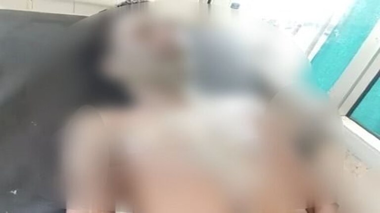 बरेली में पत्नी ने तेजाब को चूल्हे पर खूब खौलाया फिर उसमें मिर्ची मिलाई और डाल दिया पति पर UP Tak