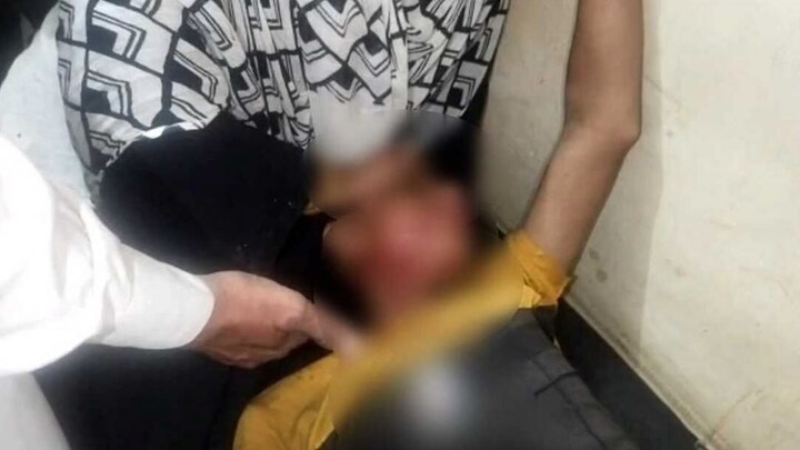 लखनऊ के बाद अब मेरठ में पिटबुल का आतंक! कुत्ते ने लड़के के चेहरे पर हमला कर उसे किया घायल UP Tak