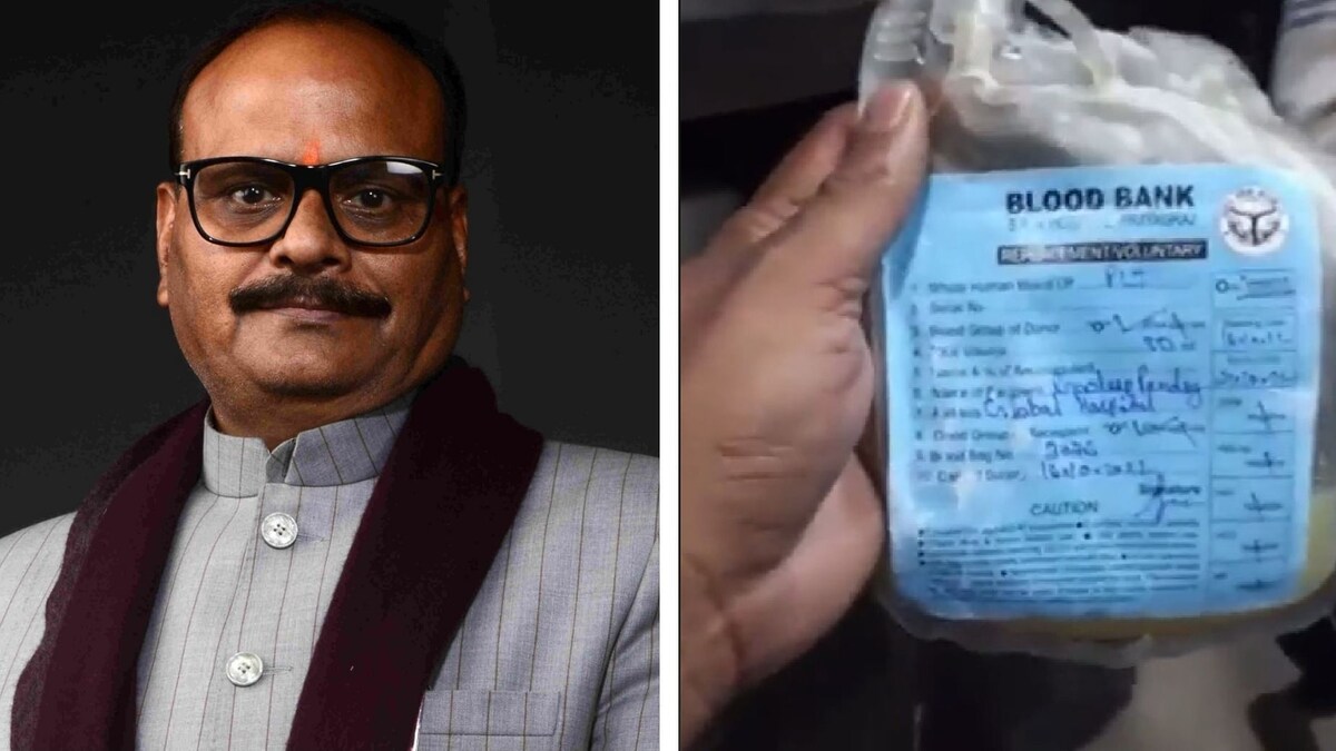 प्रयागराज: मरीज को प्लाज्मा की जगह चढ़ाया मौसम्बी का जूस? अस्पताल पर अब हुई बड़ी कार्रवाई UP Tak