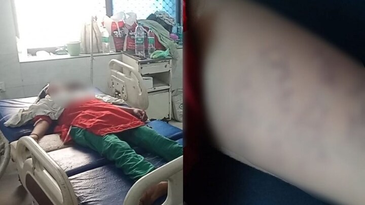 कौशांबी: कलाई पर युवक की शर्मनाक हरकत लिख किशोरी ने लगा ली फांसी, हालत नाजुक UP Tak