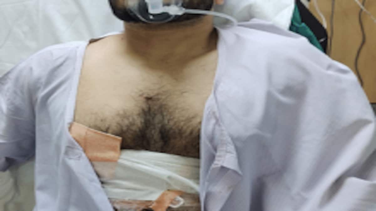 दो लड़कियों ने फोन कर बुलाया, जब स्कूटी से पहुंचा युवक तो मार दी गई गोली UP Tak