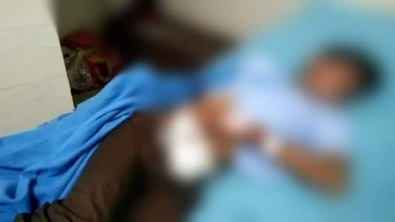 मुरादाबाद: छेड़खानी केस में नहीं हुआ समझौता! पीड़िता के भाई के प्राइवेट पार्ट पर किया हमला UP Tak