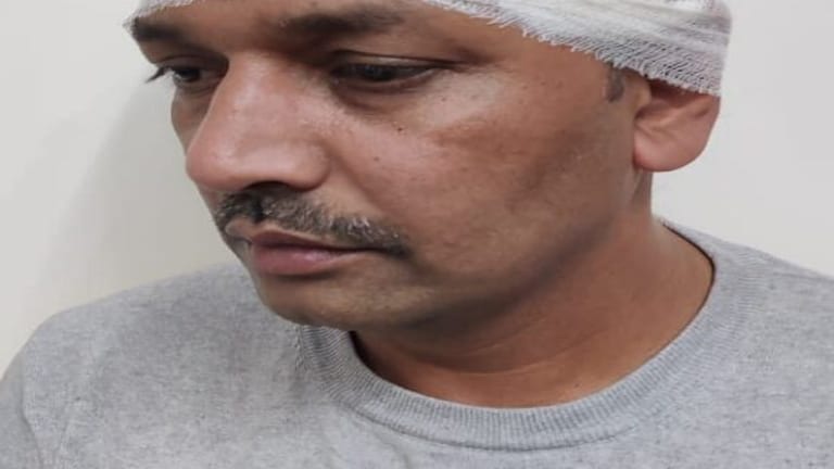 लखनऊ: कुत्ते के मालिक को टोकना डॉक्टर को पड़ा महंगा, दौड़ा-दौड़ाकर लाठी-डंडे से पीटा UPTak