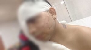 Lucknow Acid Attack: युवकों ने घर में घुसकर मां-बेटे पर फेंका एसिड, सामने आया CCTV फुटेज UP Tak
