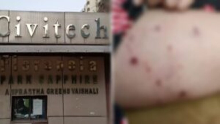 गाजियाबाद: खतरनाक पिटबुल ने 11 साल की बच्ची पर किया अटैक, सामने आई ओनर की ये लापरवाही? UP Tak