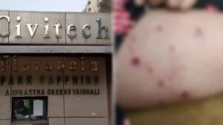 गाजियाबाद: खतरनाक पिटबुल ने 11 साल की बच्ची पर किया अटैक, सामने आई ओनर की ये लापरवाही? UP Tak