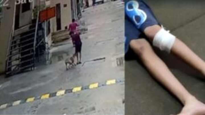 गाजियाबाद: स्ट्रीट डॉग ने बच्चे को काटा, दर्द से बिलबिला उठा मासूम, CCTV आया सामने UP Tak